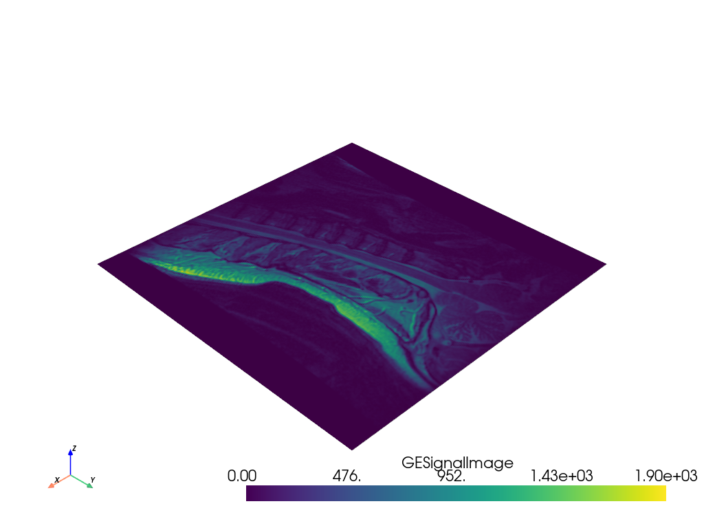 ../../../_images/pyvista-GESignaReader-25a0aa688ed46caf_00_00.png