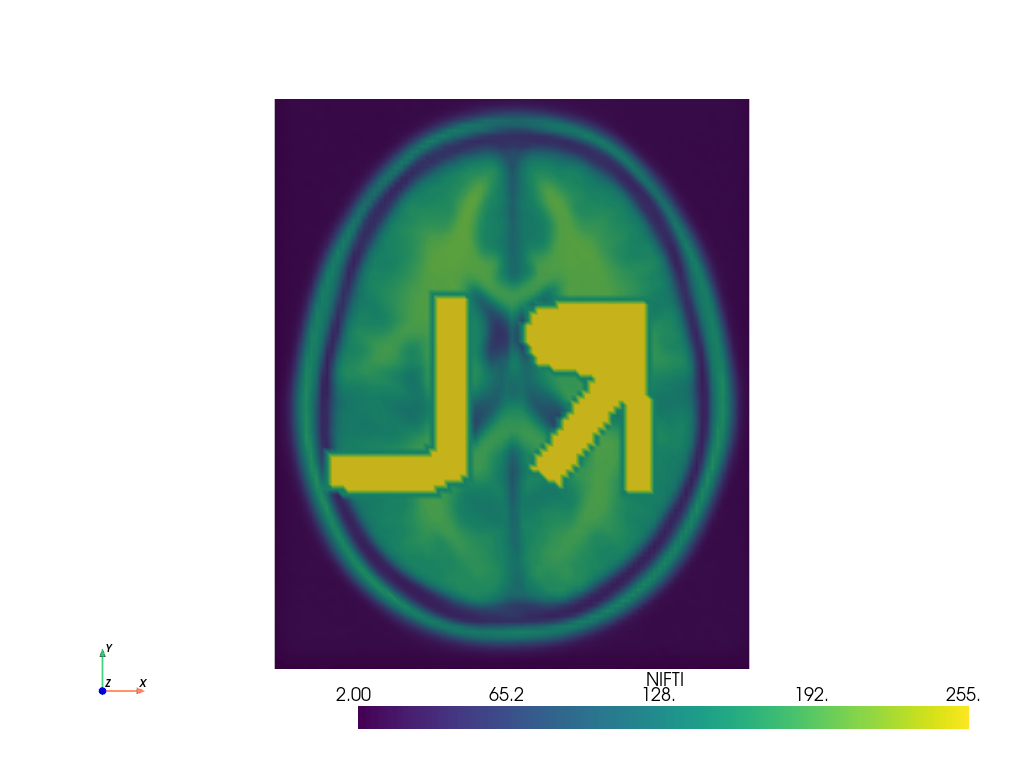 ../../_images/pyvista-examples-downloads-download_brain_atlas_with_sides-1_00_00.png