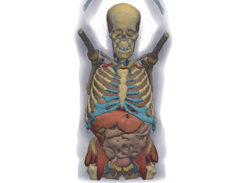 ../../../_images/pyvista-examples-downloads-download_whole_body_ct_male-9511ada8603c5140_00_00.png