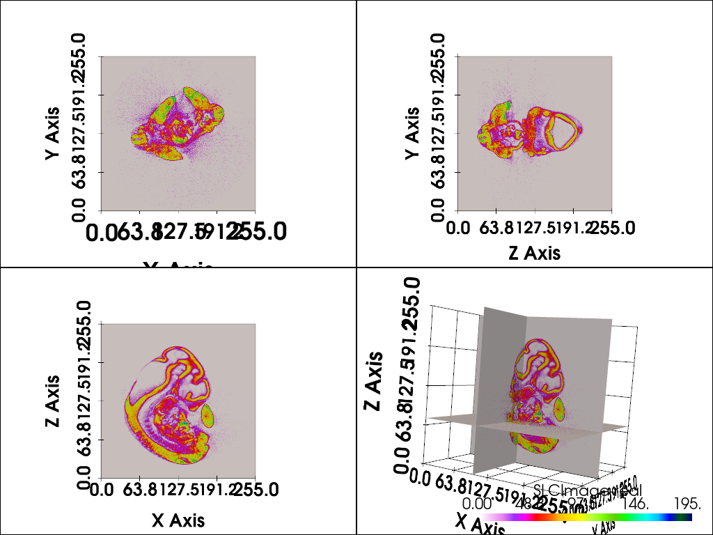 slice orthogonal
