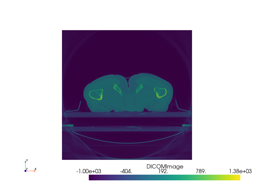 ../../../_images/pyvista-examples-downloads-download_prostate-1_00_00.png
